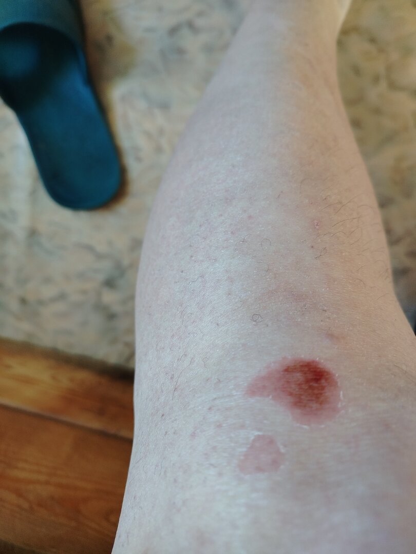 ссадина.jpg